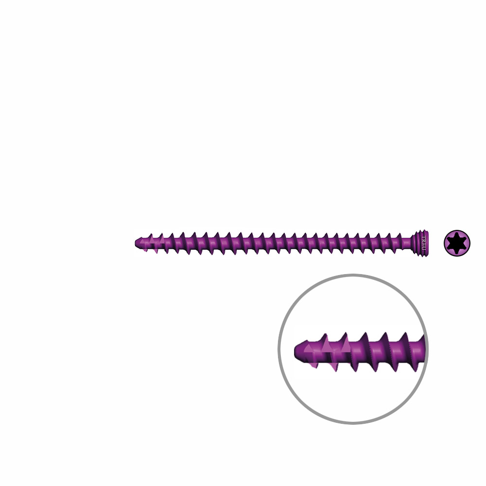 Spongiosaschraube Ø3,0mm, 42mm winkelstabil/ TI selbstschneidend 