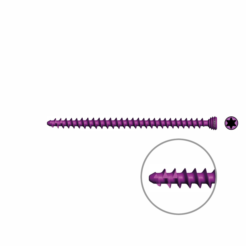 Spongiosaschraube Ø3,0mm, 48mm winkelstabil/ TI selbstschneidend 