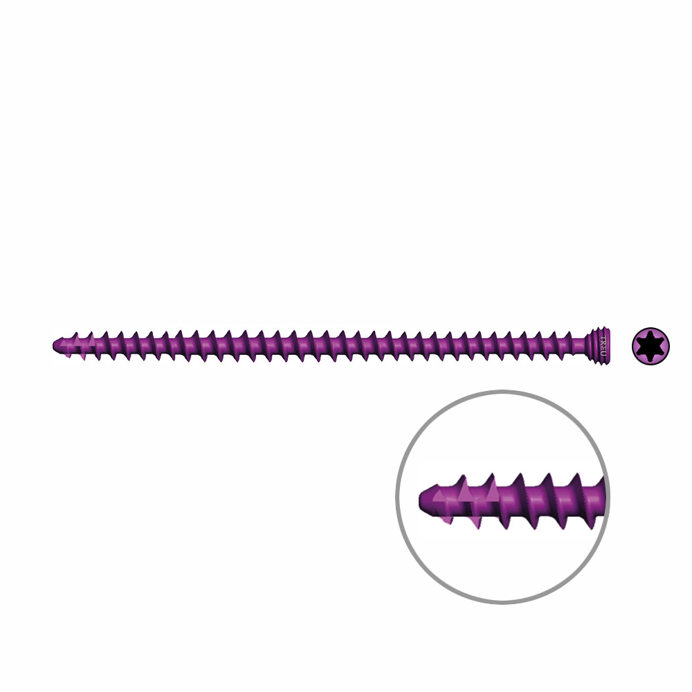 Spongiosaschraube Ø3,0mm, 56mm winkelstabil/ TI selbstschneidend 