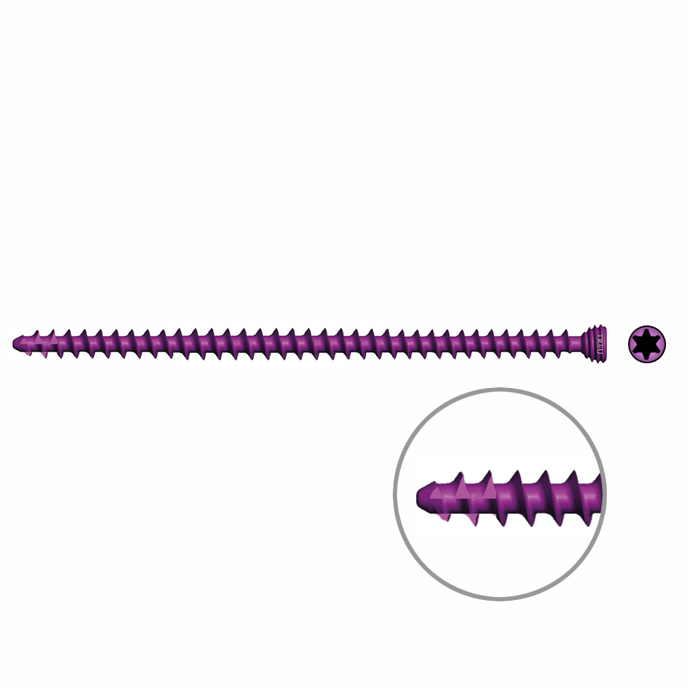 Spongiosaschraube Ø3,0mm, 60mm winkelstabil/ TI selbstschneidend 