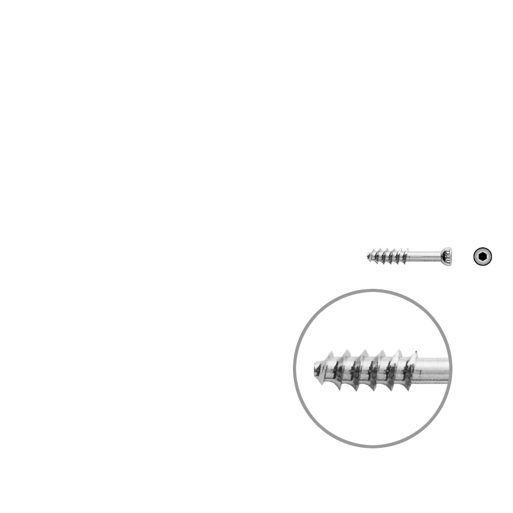 Hohlschraube 7mm Dia x 25mm 16 G 