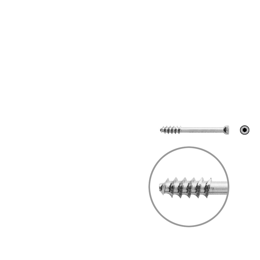 Hohlschraube 7mm Dia x 40mm 16 G 