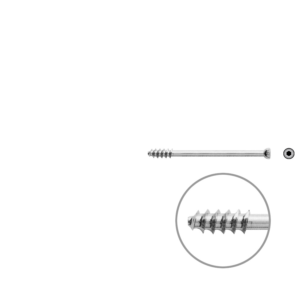 Hohlschraube 7mm Dia x 60mm 16 G 