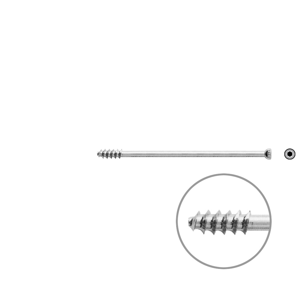 Hohlschraube 7mm Dia x 85mm 16 G 