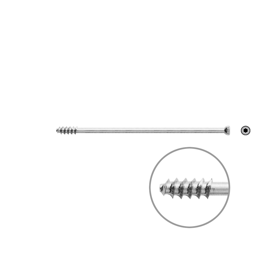 Hohlschraube 7mm Dia x 100mm 16 G 