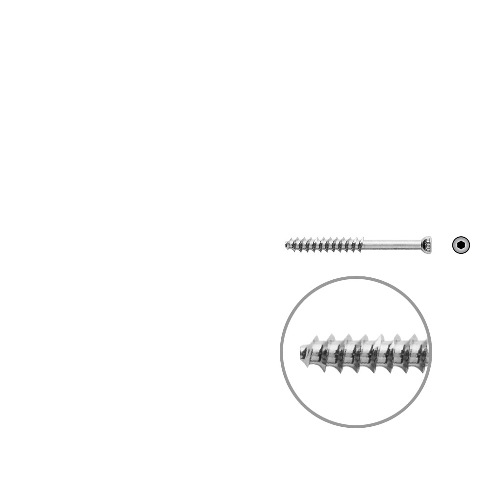 Hohlschraube 7mm Dia x 45mm 32 G 