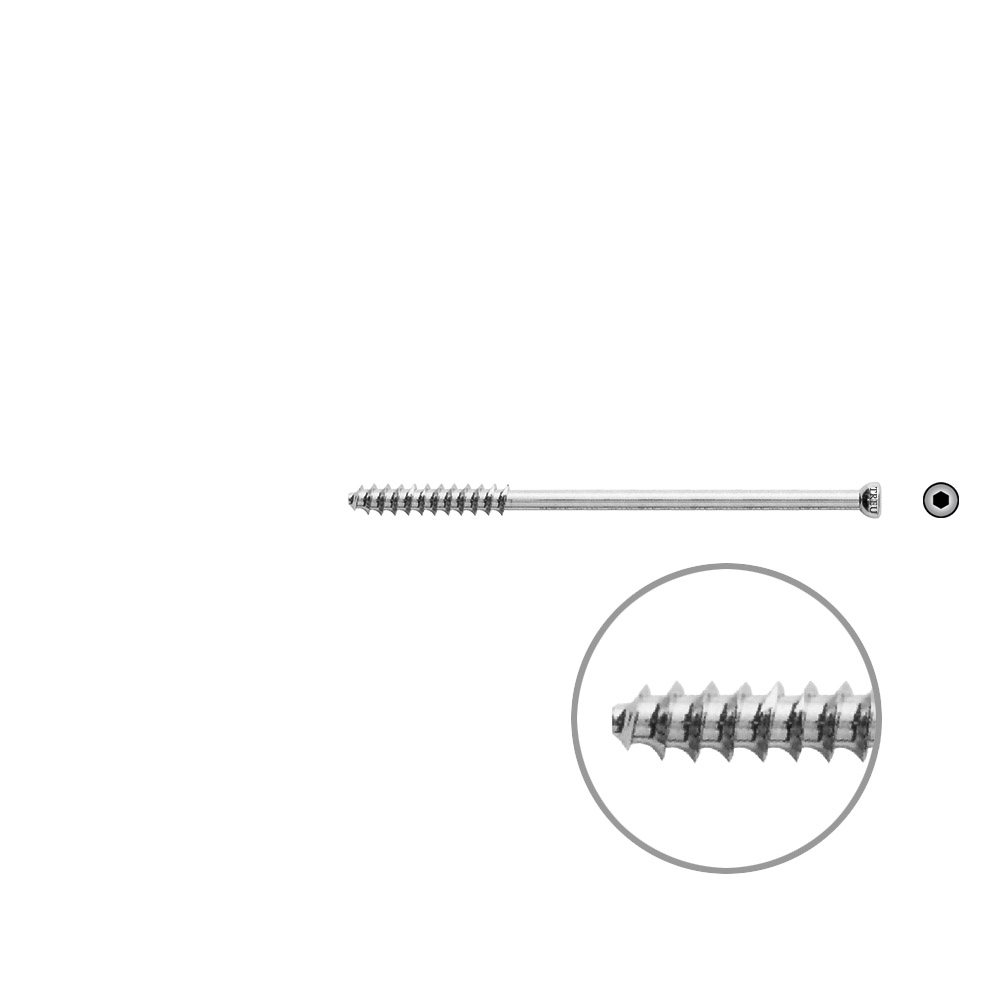 Hollow Screw 7 x 80mm thread 32mm 