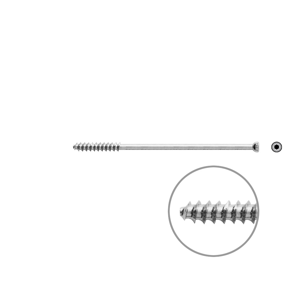 Hollow Screw 7 x 95mm thread 32mm 