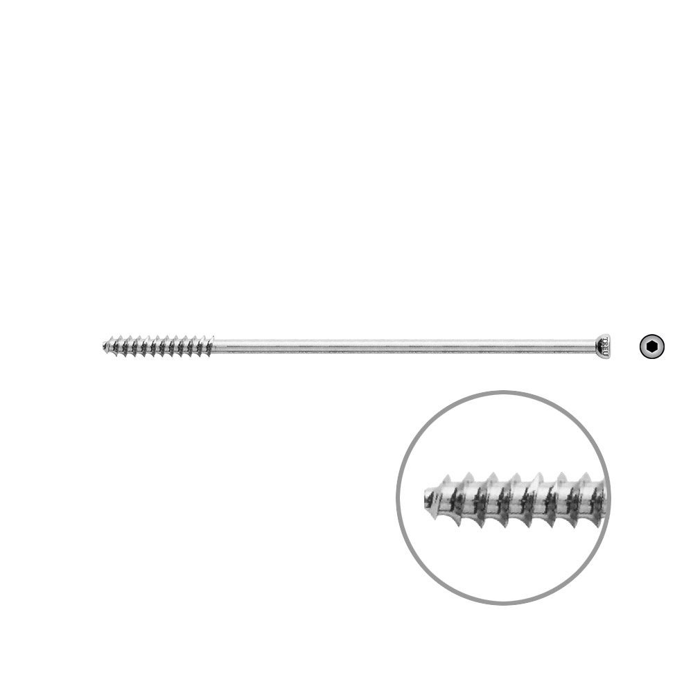 Hohlschraube 7mm Dia x 110mm 32 G 