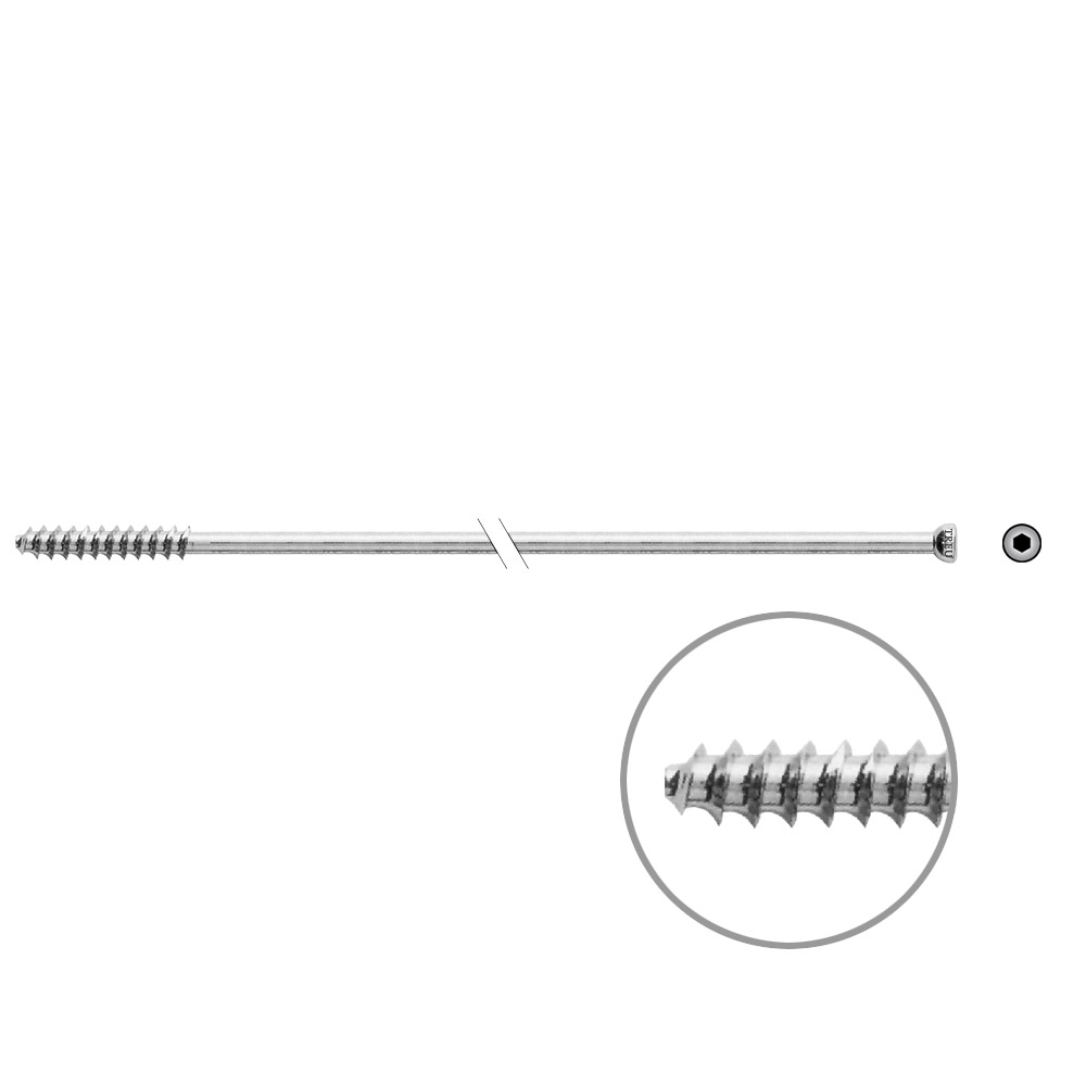 Hollow Screw 7 x 140mm thread 32mm 