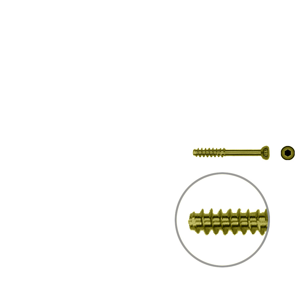 Hollow Screw 4,5 x 26mm half thread SELF TAPPING, TITAN 