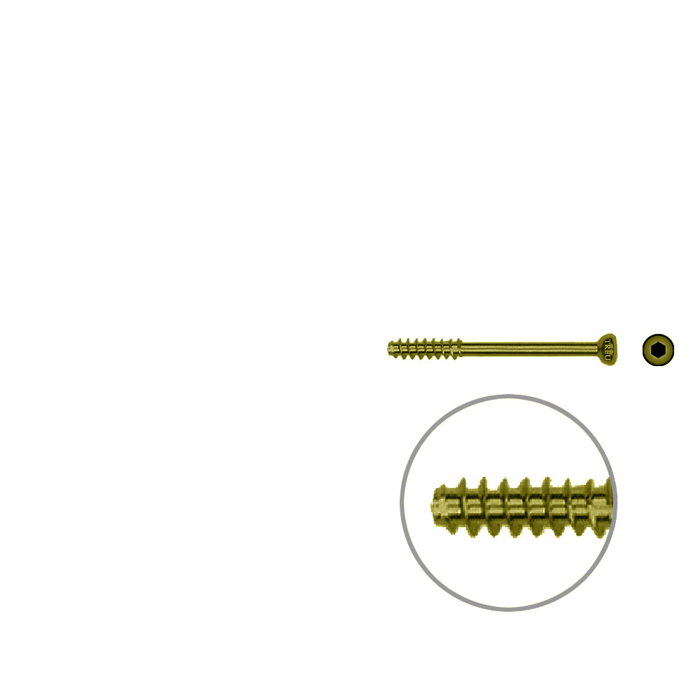 Hollow Screw 4,5 x 34mm half thread SELF TAPPING, TITAN 