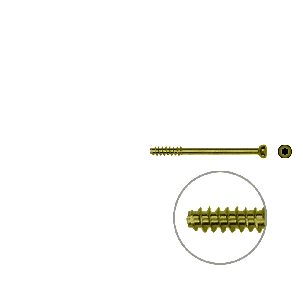 Hollow Screw 4,5 x 40mm half thread SELF TAPPING, TITAN 