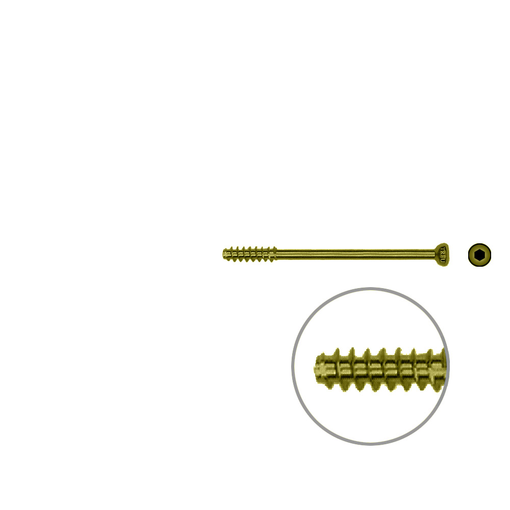 Hollow Screw 4,5 x 46mm half thread SELF TAPPING, TITAN 