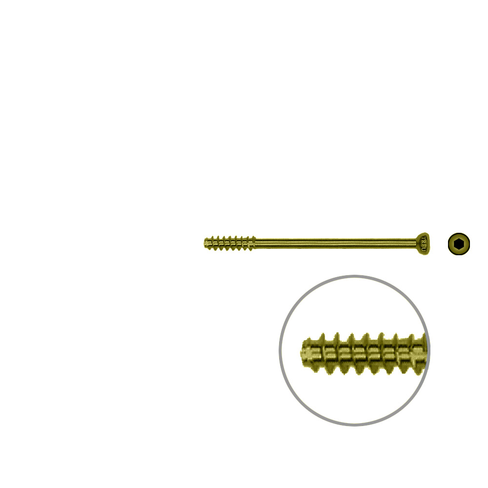 Hollow Screw 4,5 x 48mm half thread SELF TAPPING, TITAN 