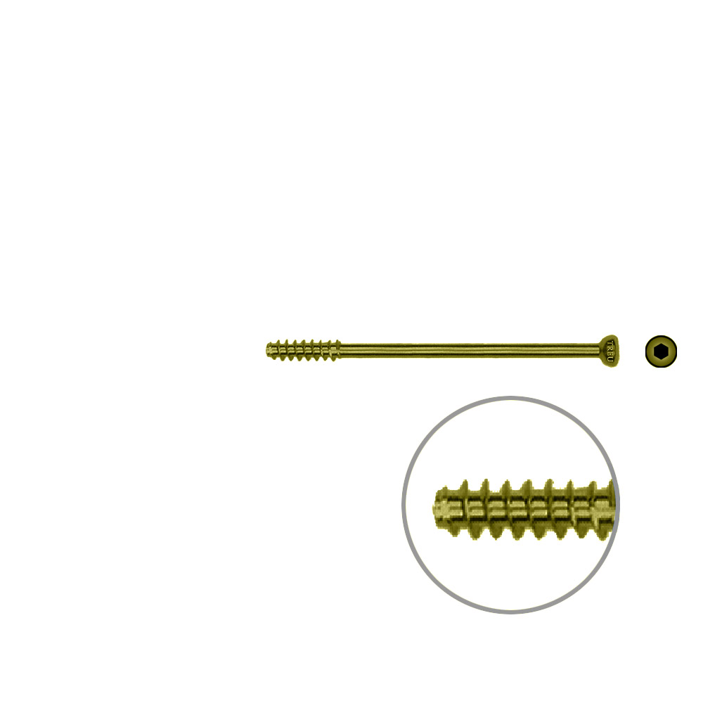 Hollow Screw 4,5 x 52mm half thread SELF TAPPING, TITAN 