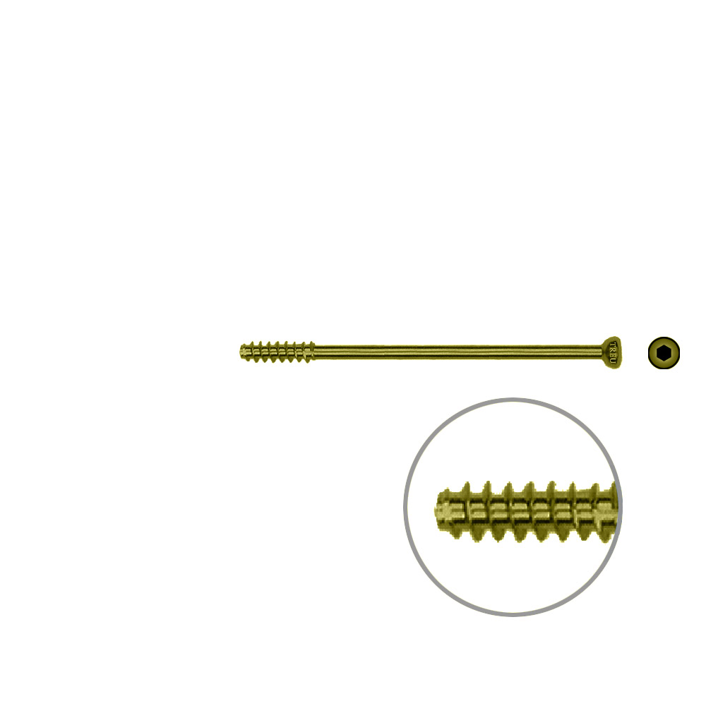 Hollow Screw 4,5 x 56mm half thread SELF TAPPING, TITAN 