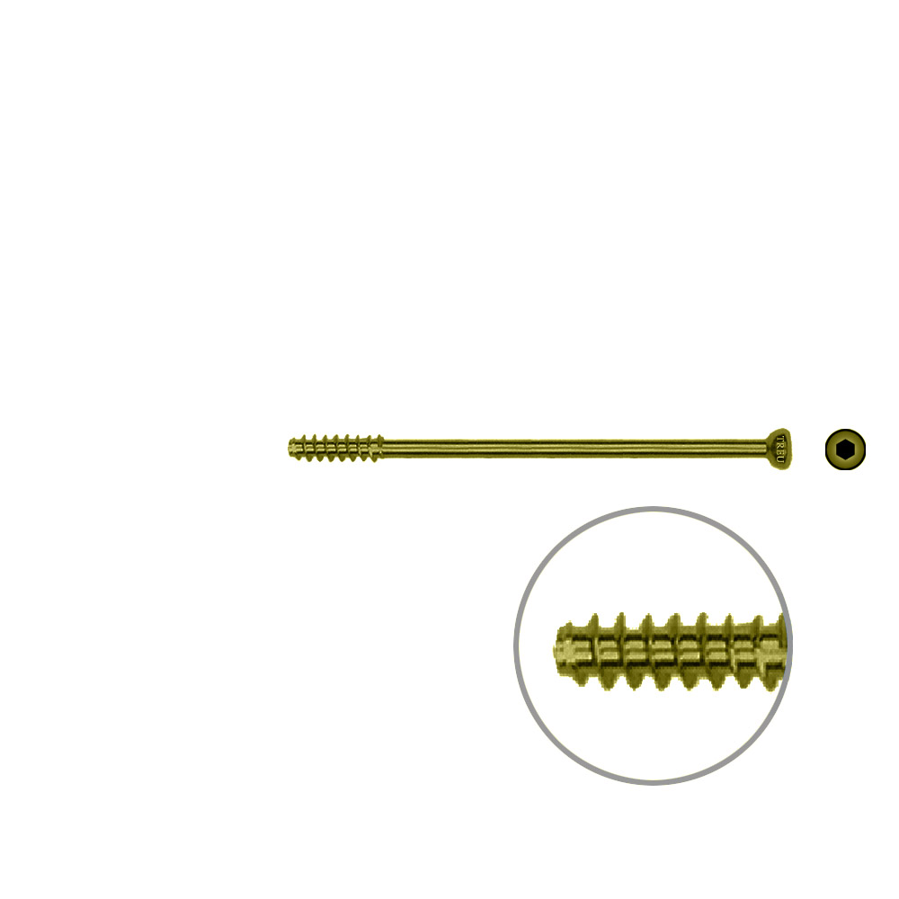 Hollow Screw 4,5 x 58mm half thread SELF TAPPING, TITAN 