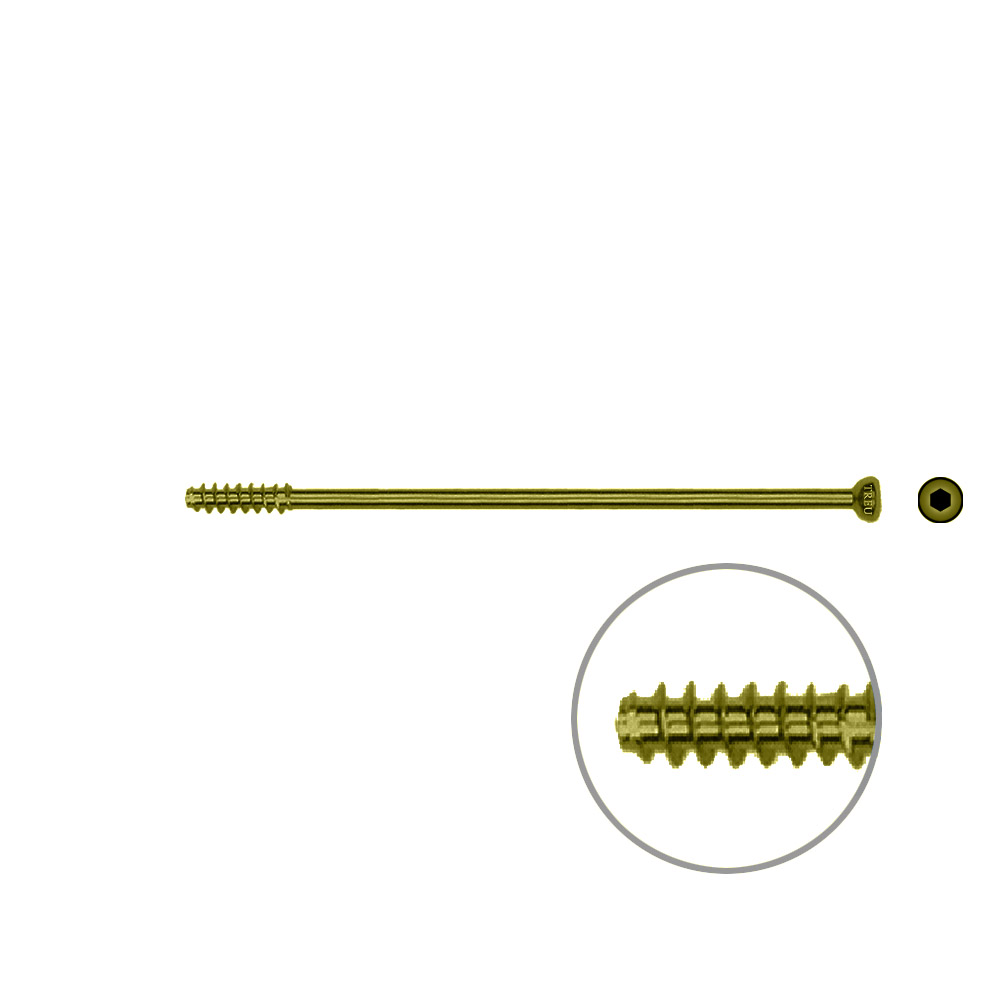 Hollow Screw 4,5 x 72mm half thread SELF TAPPING, TITAN 