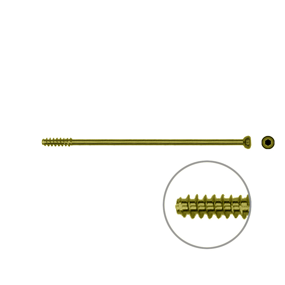 Hollow Screw 4,5 x 76mm half thread SELF TAPPING, TITAN 