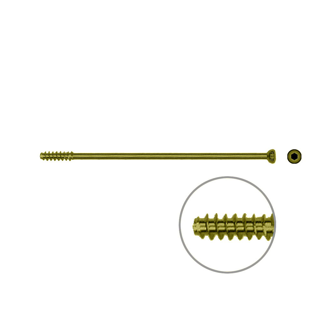 Hollow Screw 4,5 x 78mm half thread SELF TAPPING, TITAN 