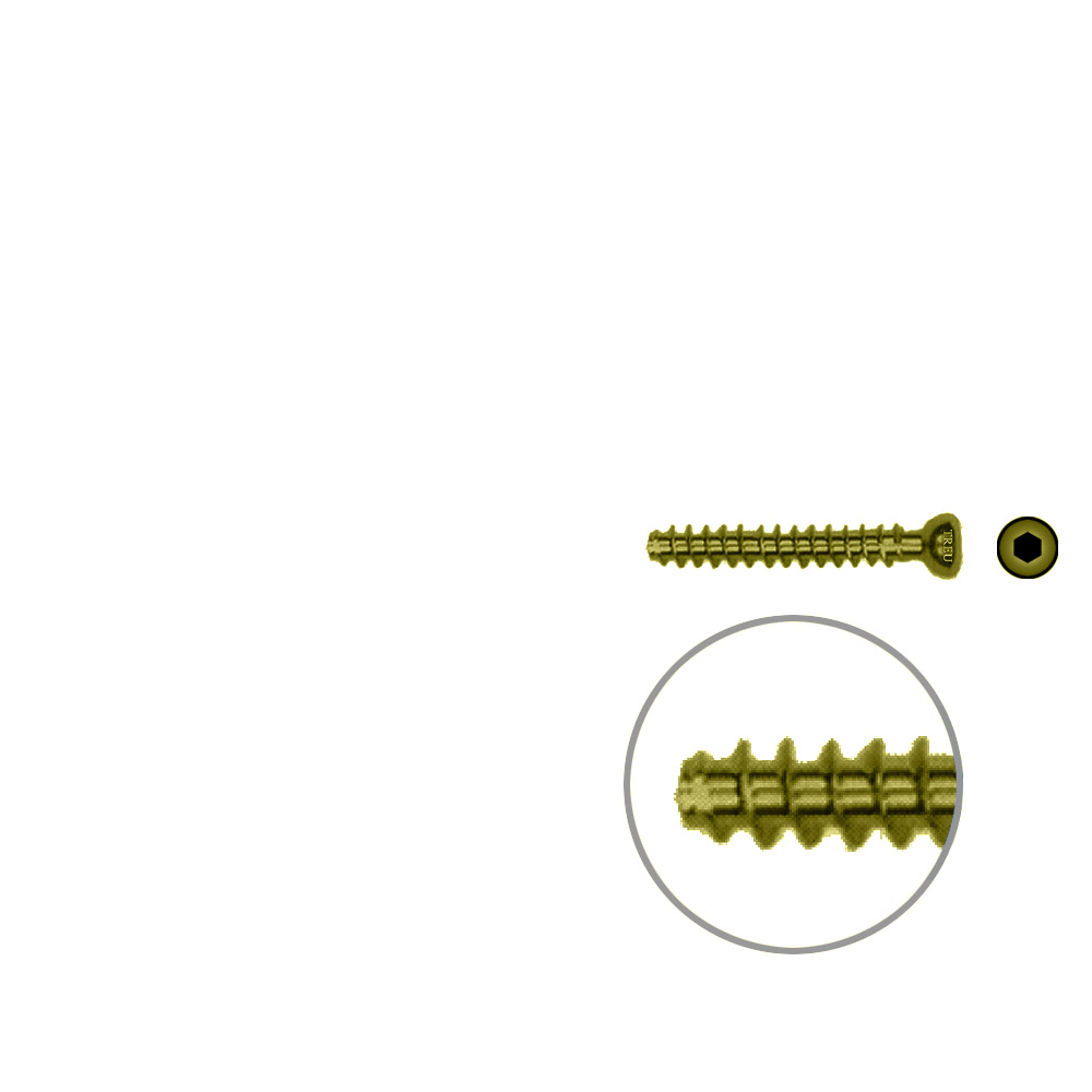 Hollow Screw 4,5 x 30mm full thread SELF TAPPING TITAN 