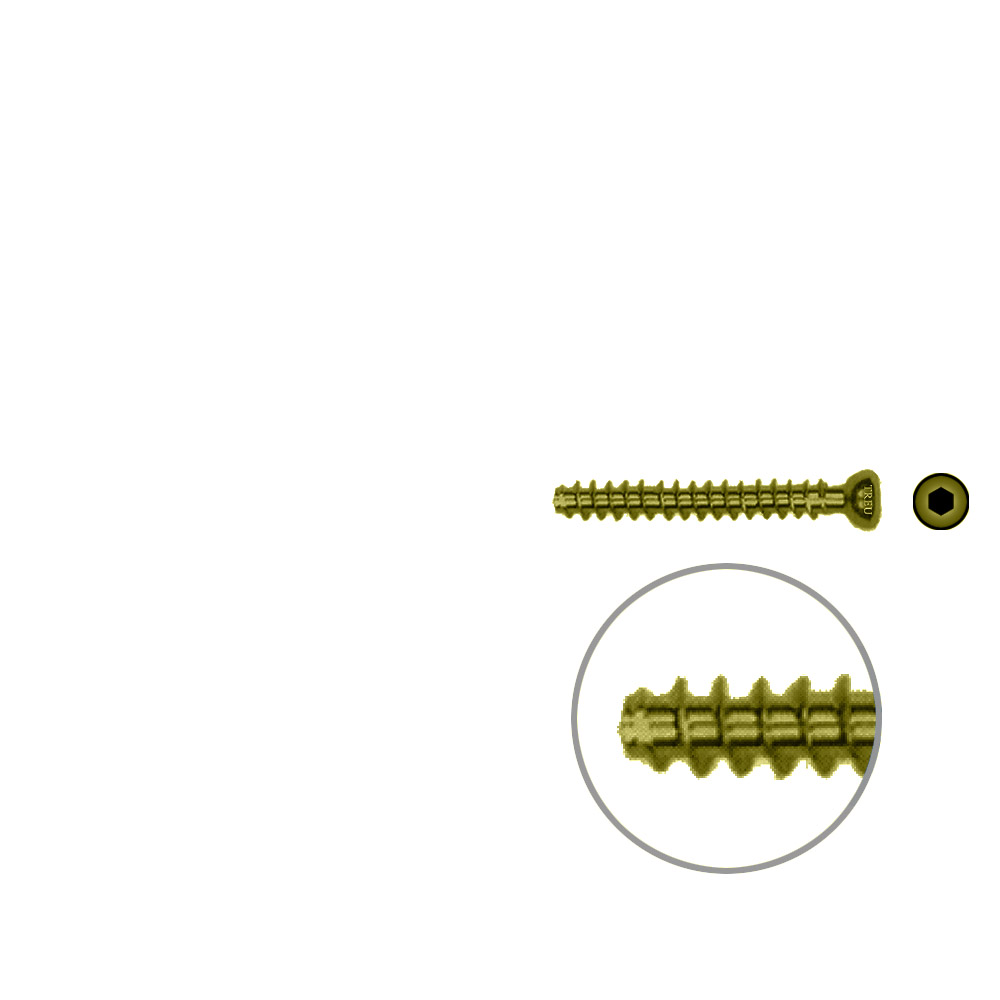 Hollow Screw 4,5 x 34mm full thread SELF TAPPING TITAN 