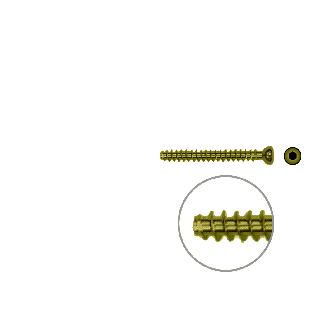 Hollow Screw 4,5 x 38mm full thread SELF TAPPING TITAN 