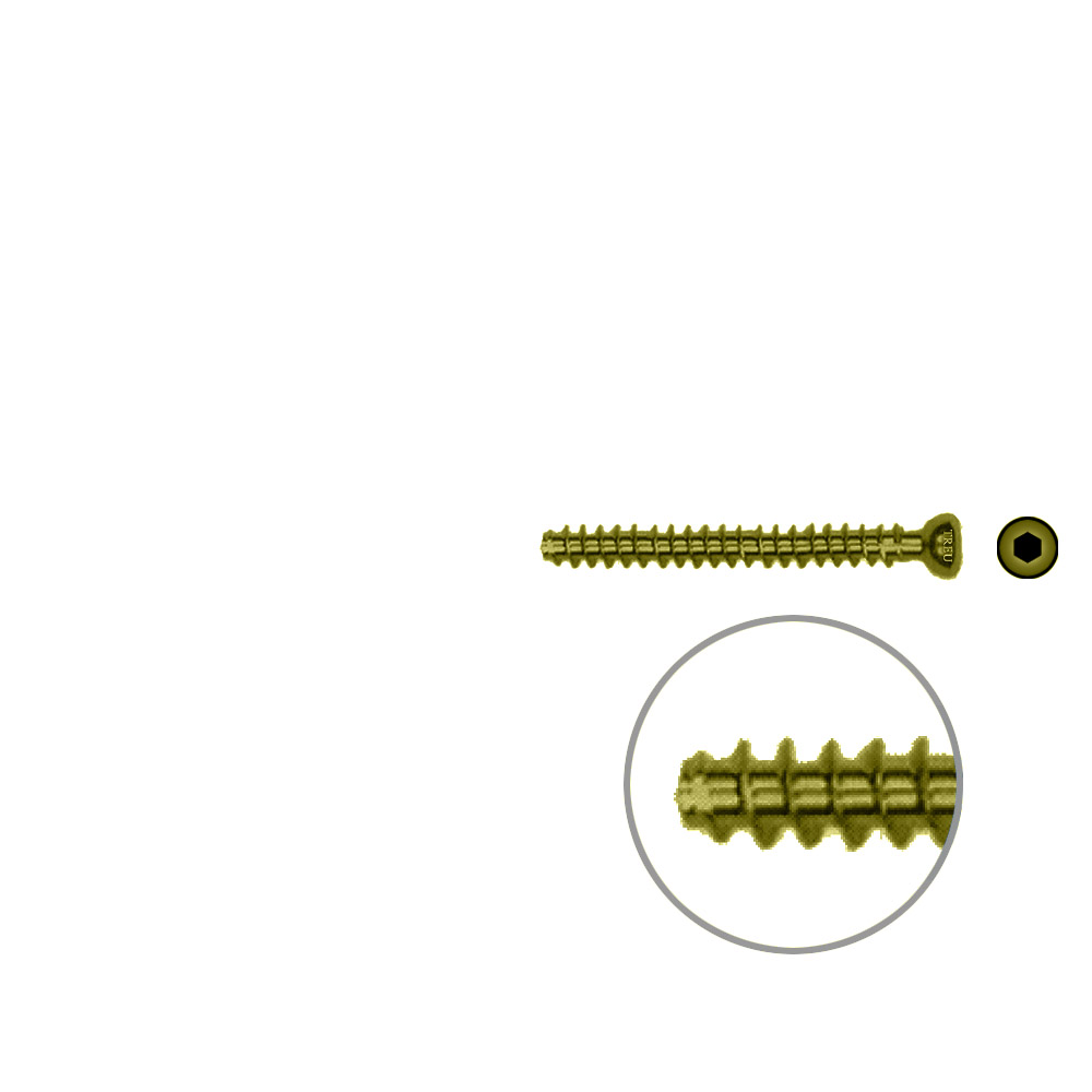 Hollow Screw 4,5 x 40mm full thread SELF TAPPING TITAN 