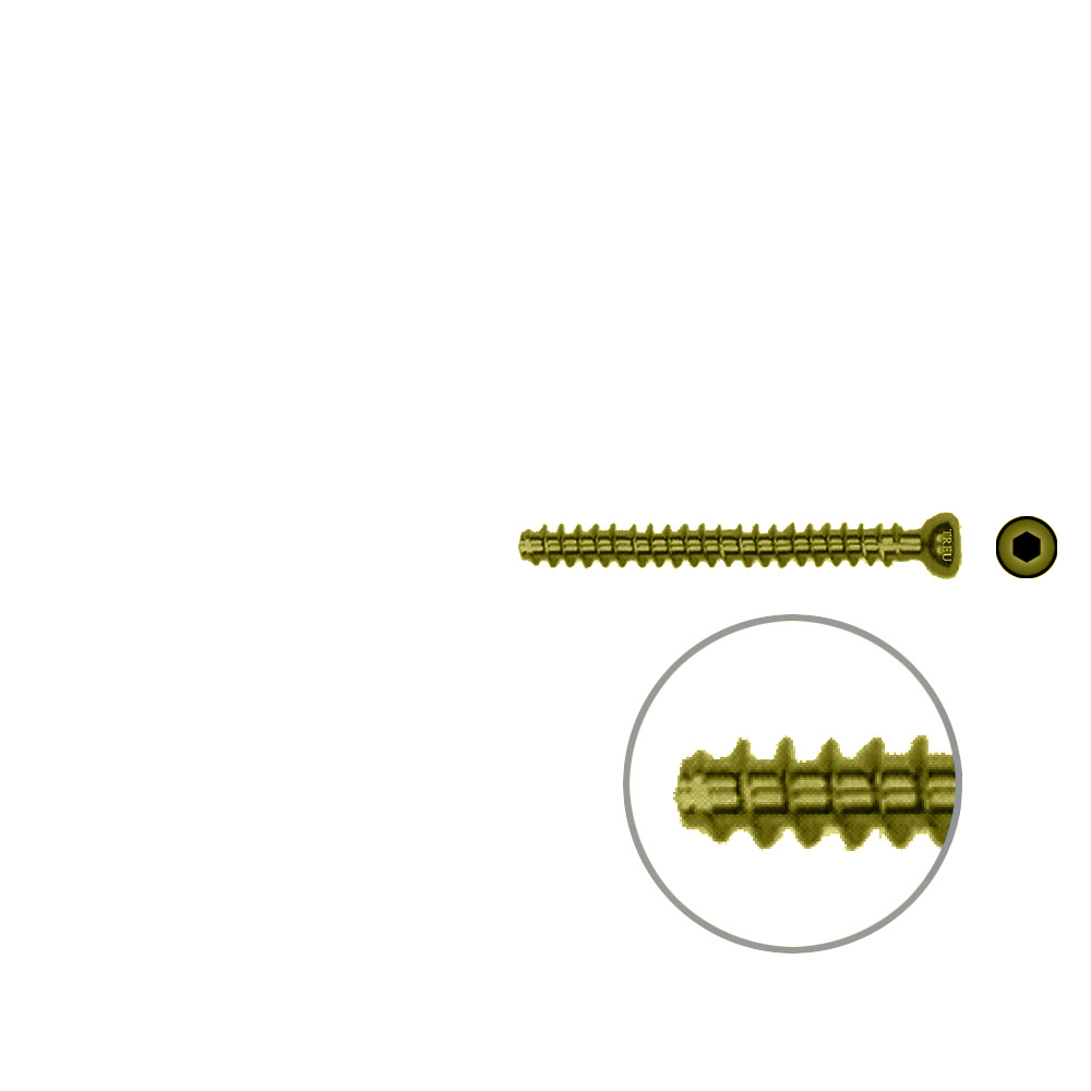 Hollow Screw 4,5 x 42mm full thread SELF TAPPING TITAN 