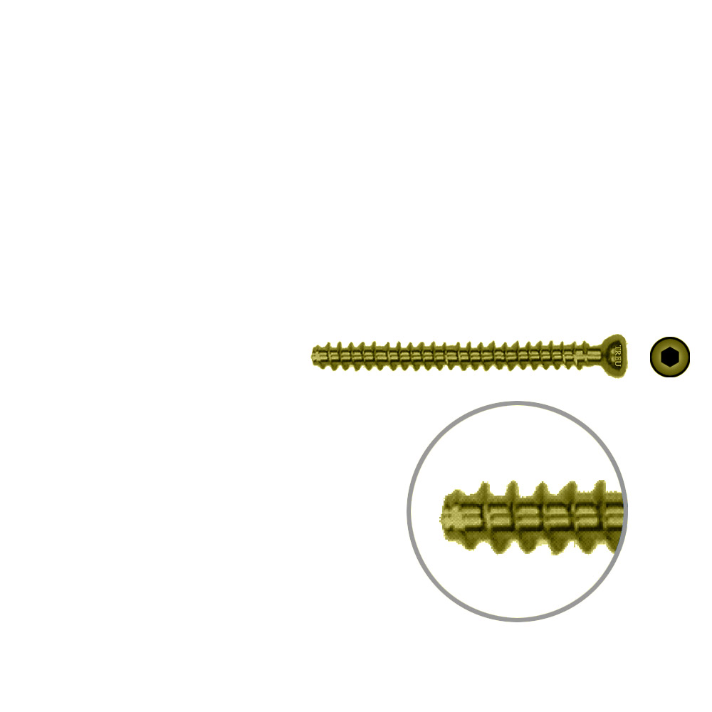 Hollow Screw 4,5 x 46mm full thread SELF TAPPING TITAN 