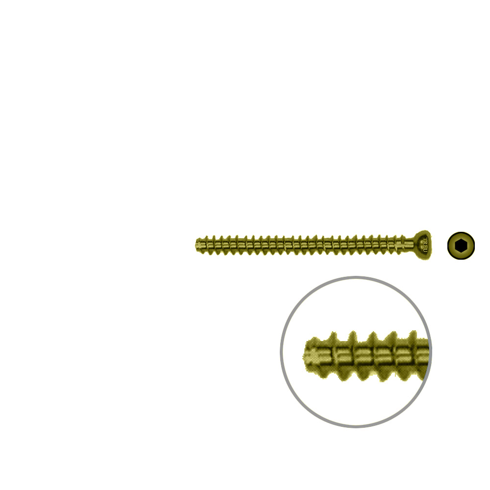 Hollow Screw 4,5 x 50mm full thread SELF TAPPING TITAN 