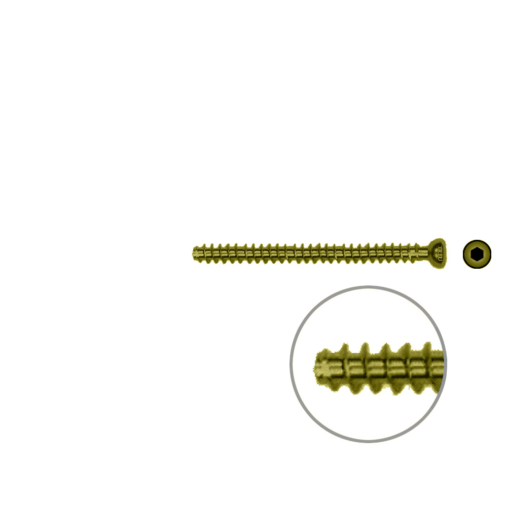 Hollow Screw 4,5 x 52mm full thread SELF TAPPING TITAN 