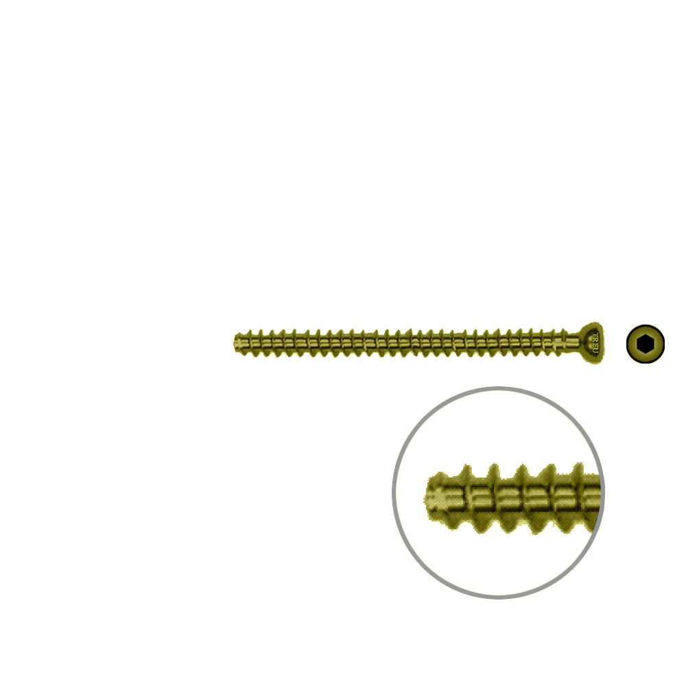 Hollow Screw 4,5 x 56mm full thread SELF TAPPING TITAN 