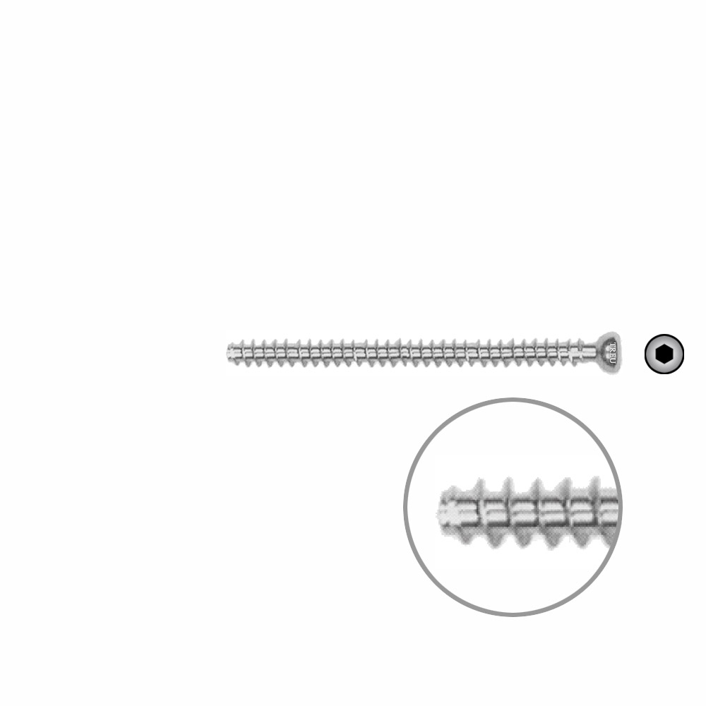 Hollow Screw 4,5mm x 58mm fullthread SELF TAPPING 