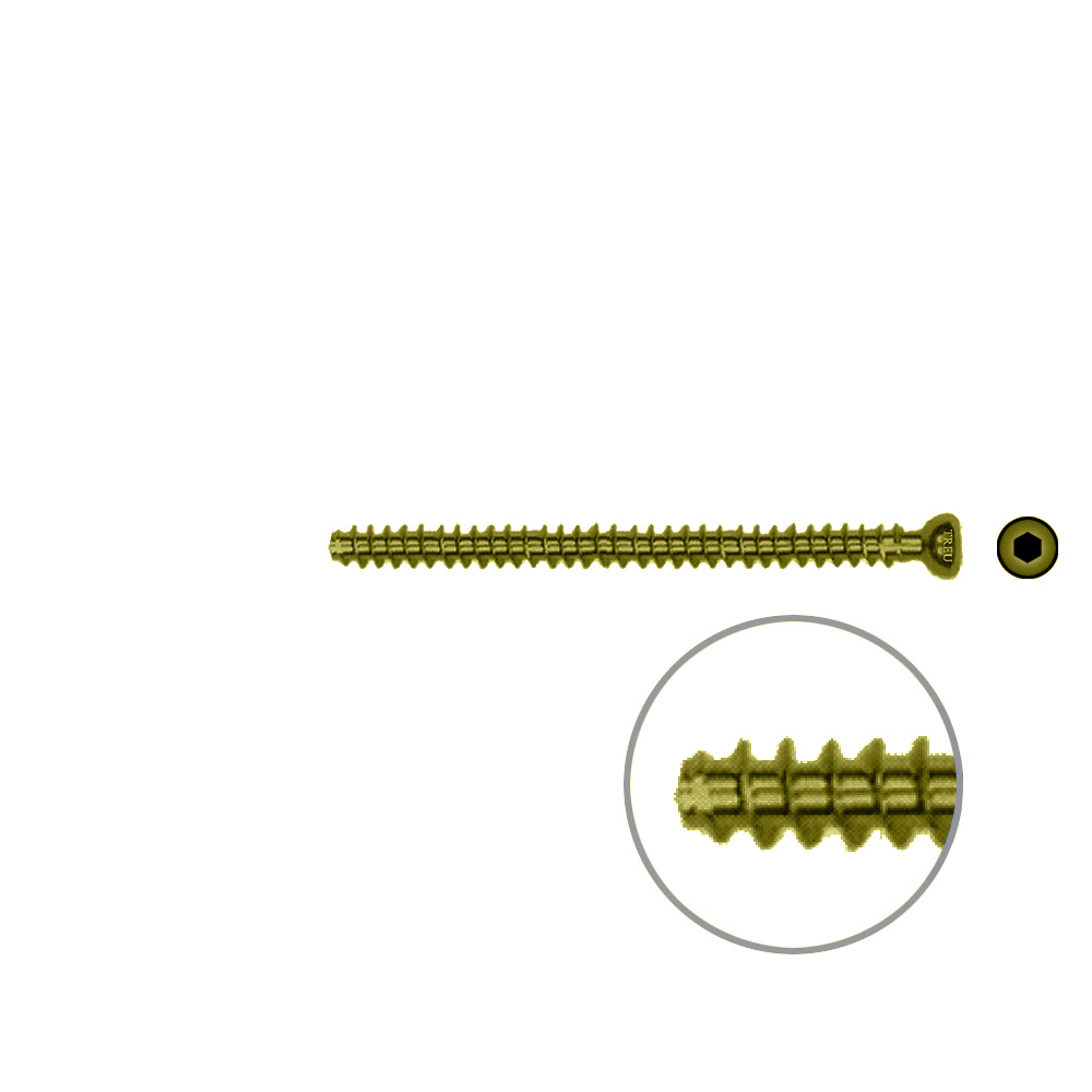 Hollow Screw 4,5 x 60mm full thread SELF TAPPING TITAN 