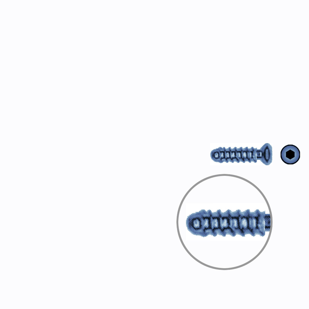 Hollow Screw 3,5 x 14mm thread 5mm SELF TAPPING TITANIUM 