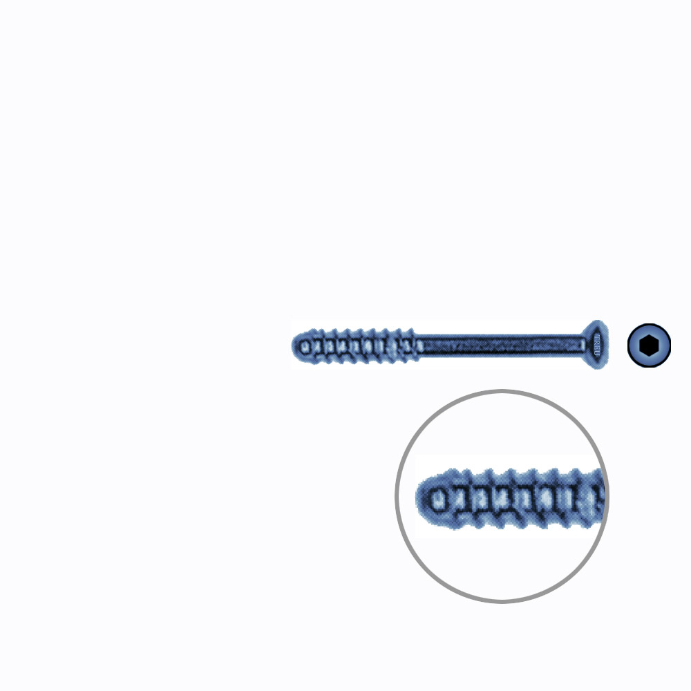 Hollow Screw 3,5 x 32mm thread 11mm SELF TAPPING TITANIUM 