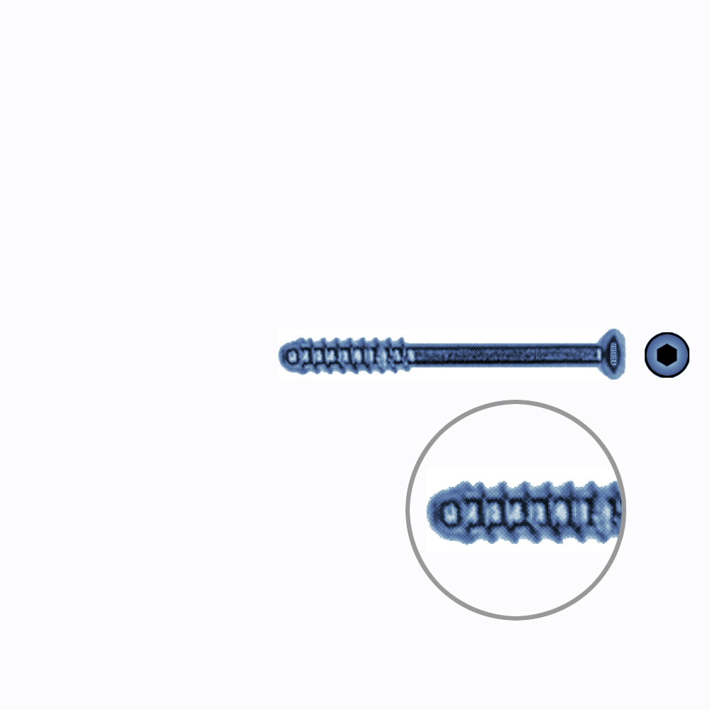 Hollow Screw 3,5 x 34mm thread 11mm SELF TAPPING TITANIUM 