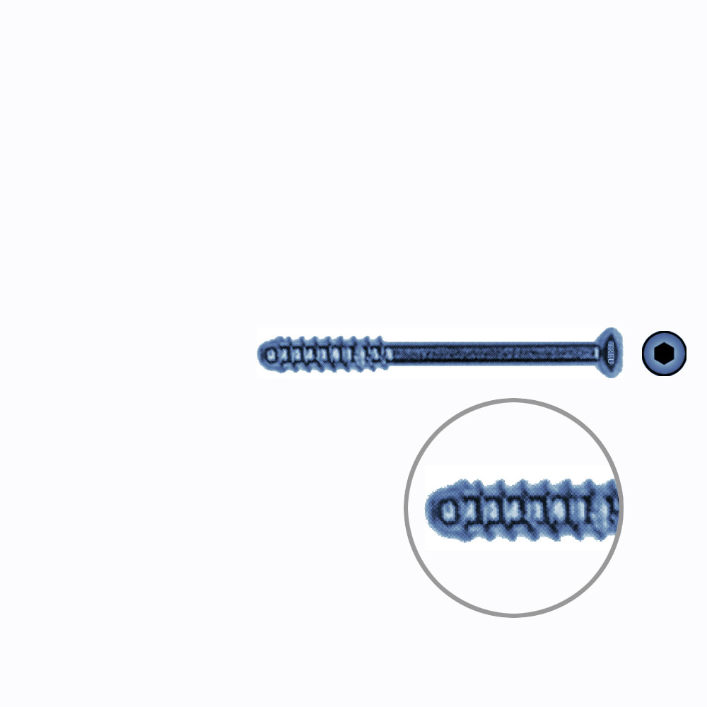 Hollow Screw 3,5 x 36mm thread 11mm SELF TAPPING TITANIUM 