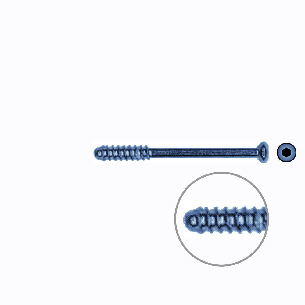 Hollow Screw 3,5 x 40mm thread 13mm SELF TAPPING TITANIUM 