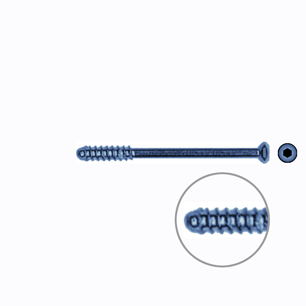 Hollow Screw 3,5 x 44mm thread 14mm SELF TAPPING TITANIUM 