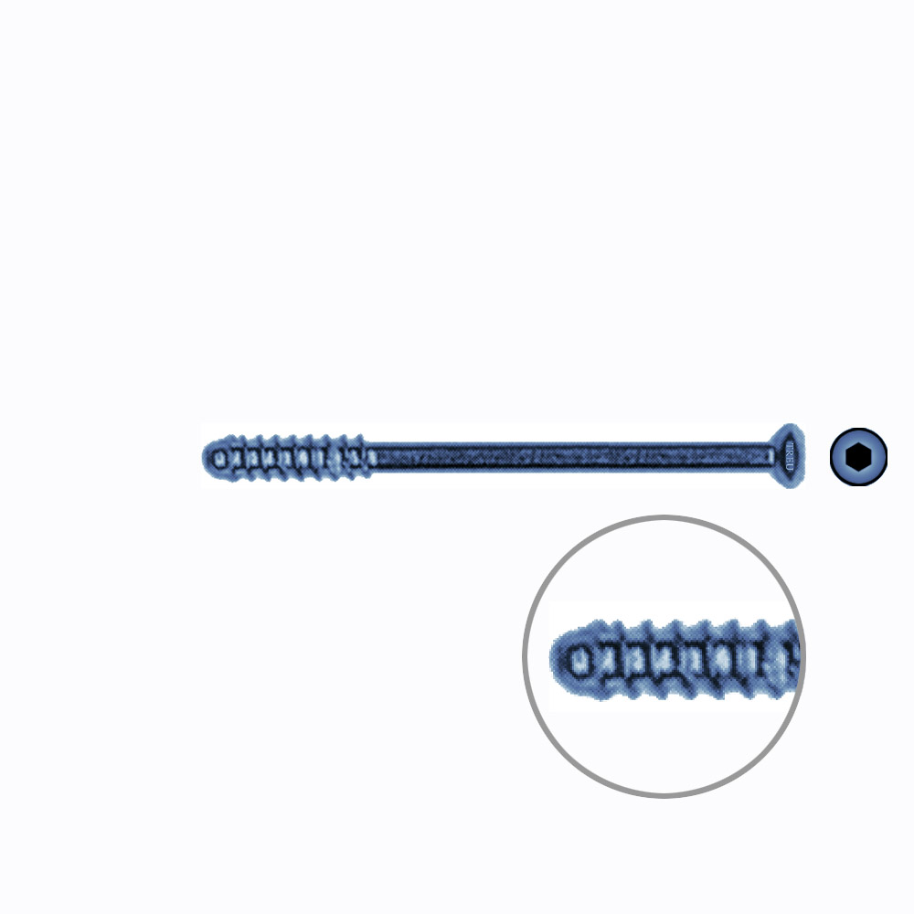 Hollow Screw 3,5 x 46mm thread 15mm SELF TAPPING TITANIUM 