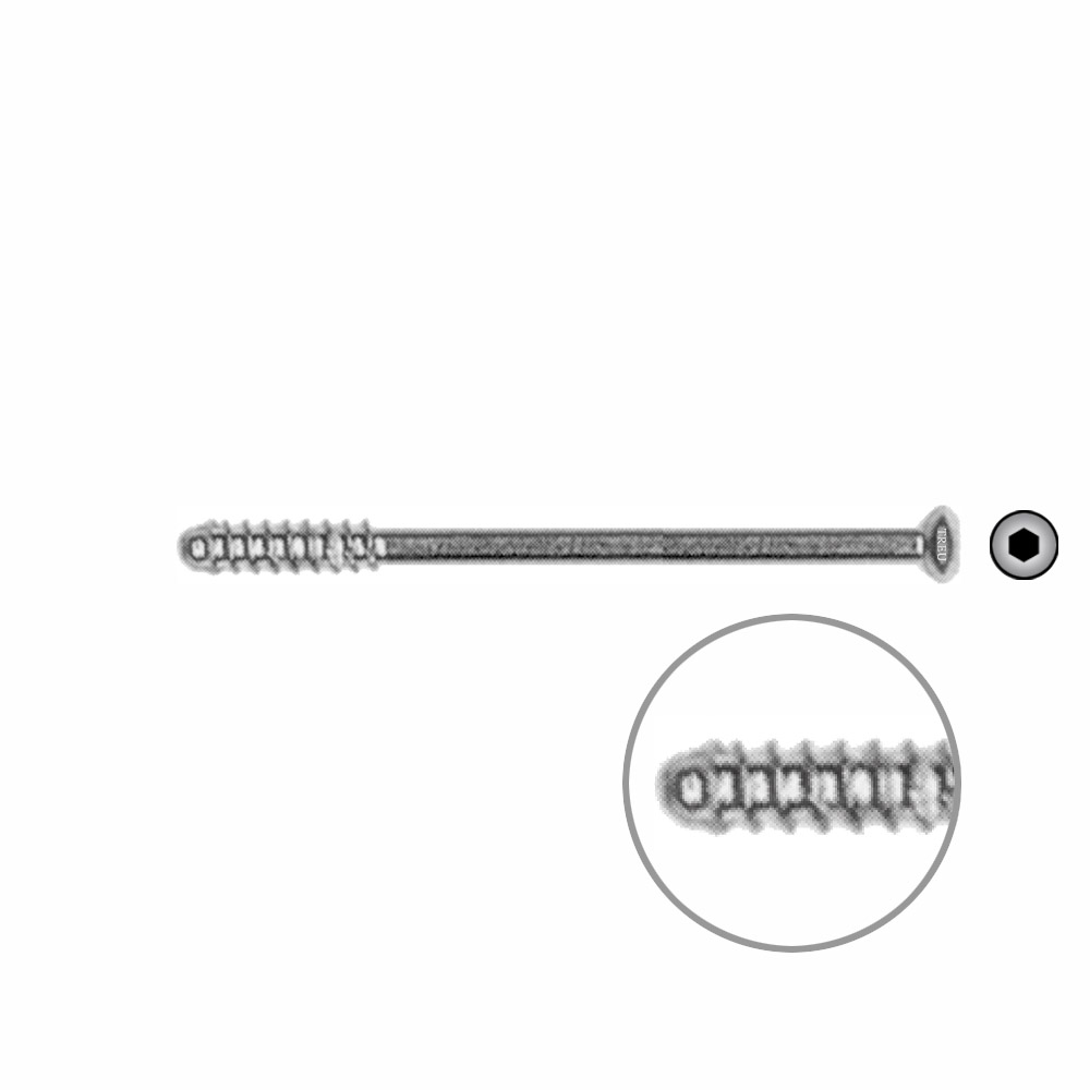 Hollow Screw 3,5 x 50mm thread 16mm SELF TAPPING 