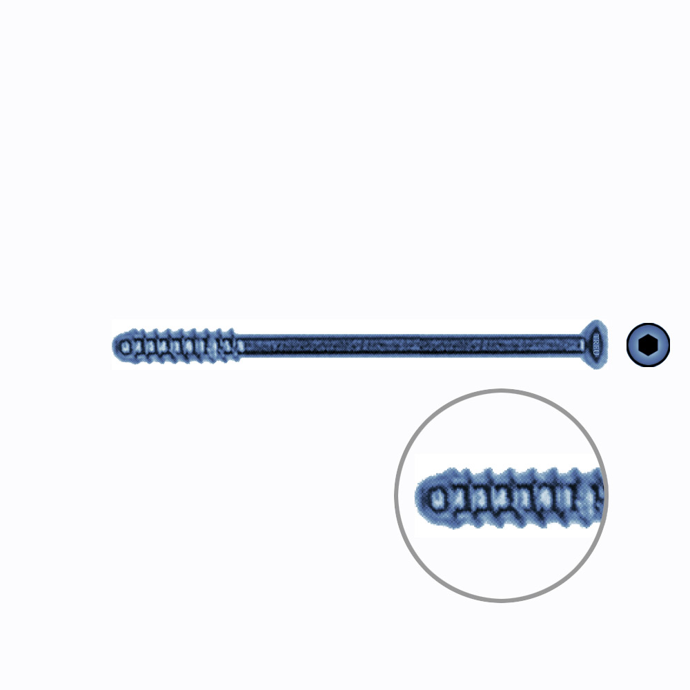 Hollow Screw 3,5 x 50mm thread 16mm SELF TAPPING TITANIUM 