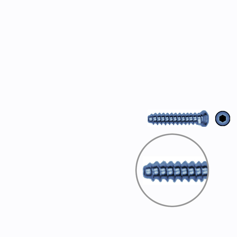 Hollow Screw 3,5 x 18mm full thread SELF TAPPING TITANIUM 