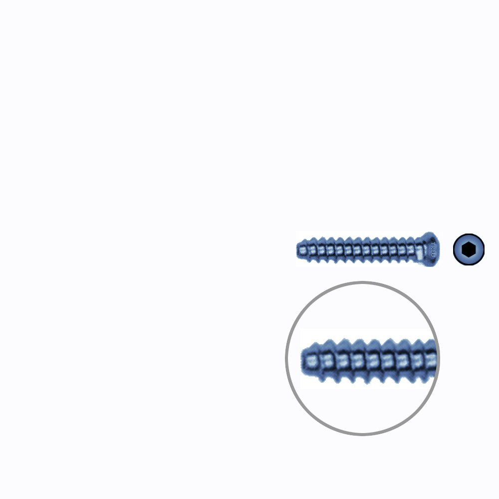 Hollow Screw 3,5 x 20mm full thread SELF TAPPING TITANIUM 