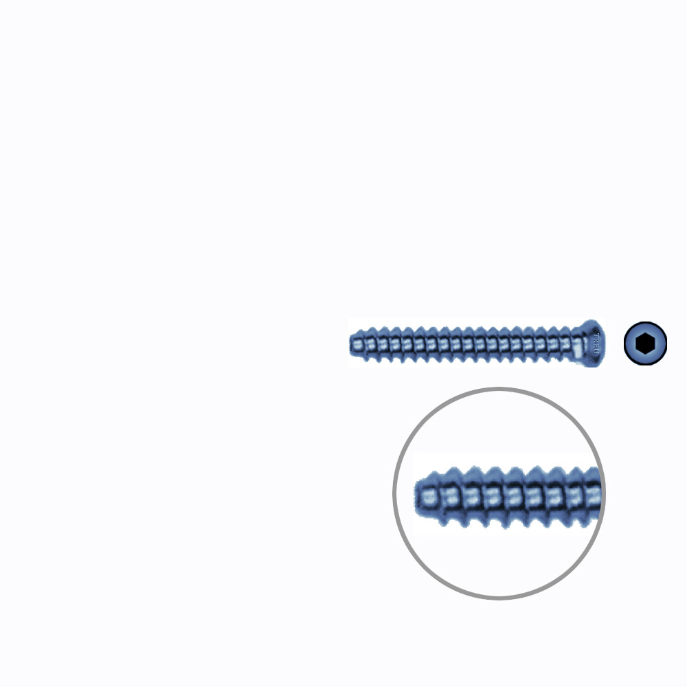 Hollow Screw 3,5 x 26mm full thread SELF TAPPING TITANIUM 