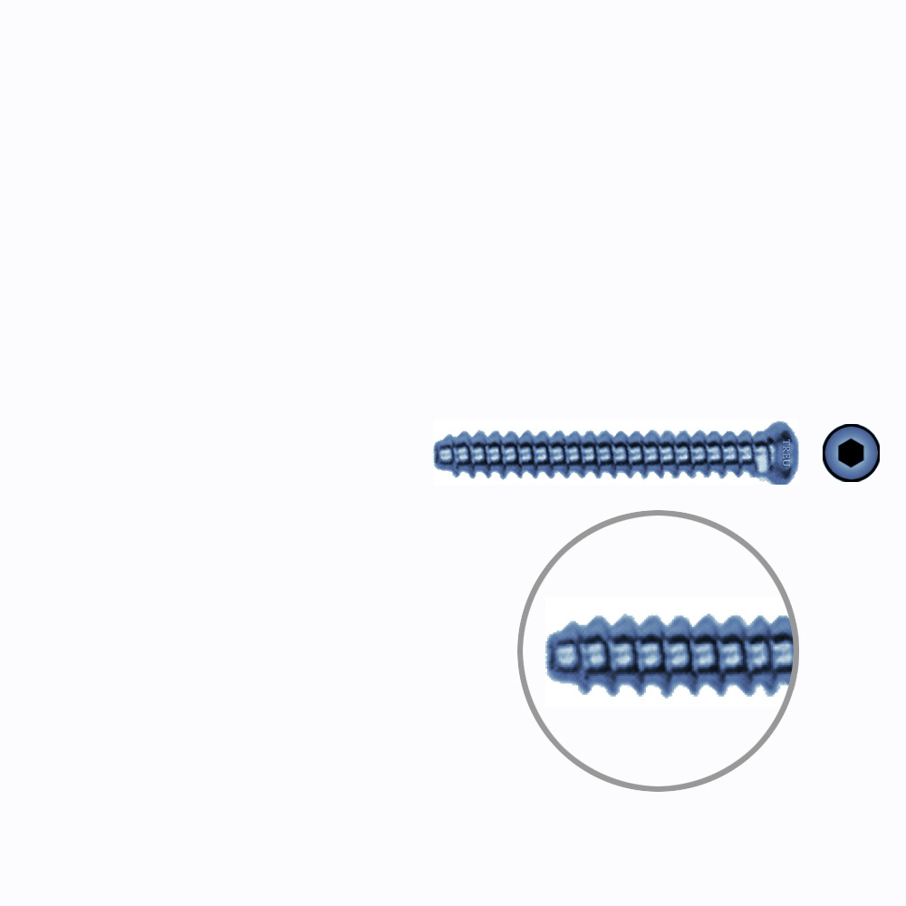 Hollow Screw 3,5 x 28mm full thread SELF TAPPING TITANIUM 