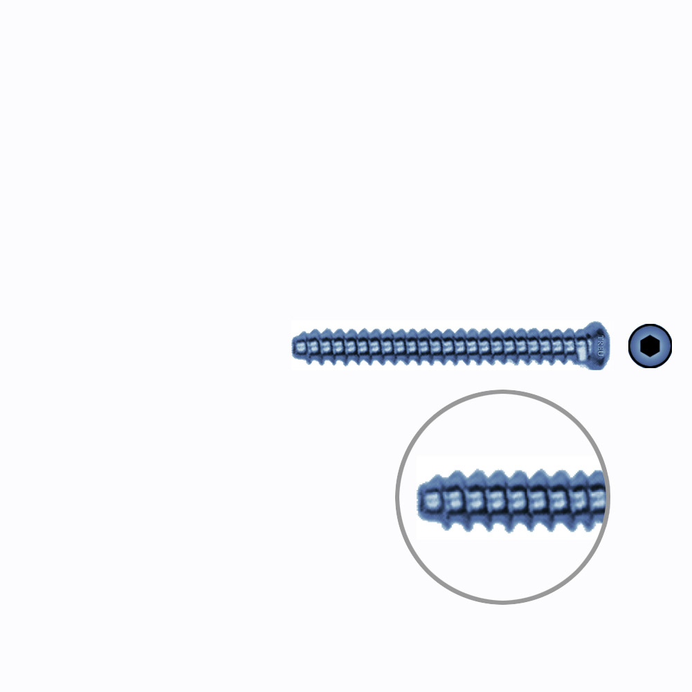 Hollow Screw 3,5 x 32mm full thread SELF TAPPING TITANIUM 